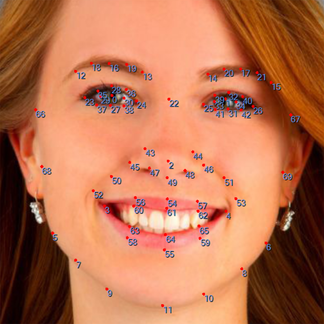 Detected Features
